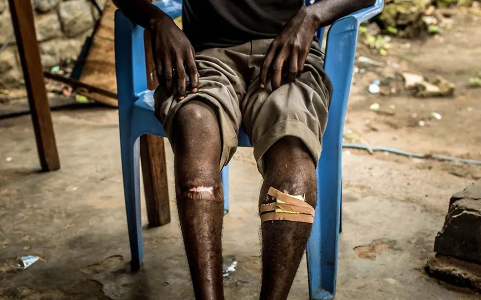 Demokratische Republik Kongo: Kinder werden zum Kämpfen gezwungen | © UNICEF/Tremeau Kindersoldaten im Kongo sind vor allem selbst Opfer der Gewalt