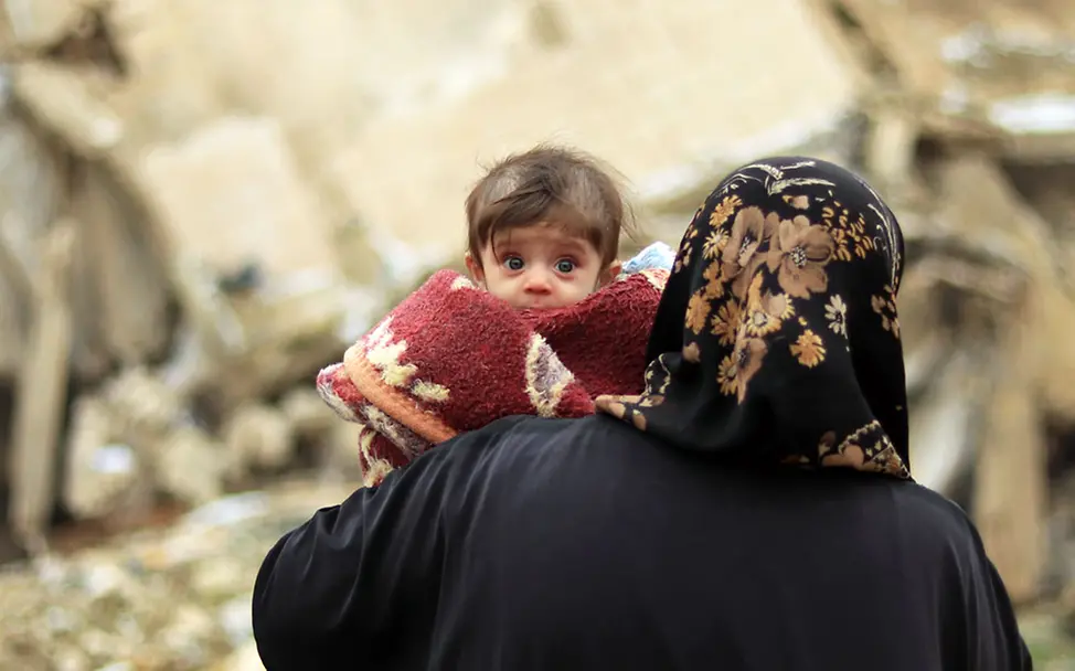 Kinder wie Jana brauchen dringend Hilfe | © UNICEF/Romenzi Bürgerkrieg in Syrien: Jana aus Aleppo ist mangelernährt und braucht dringend humanitäre Hilfe.