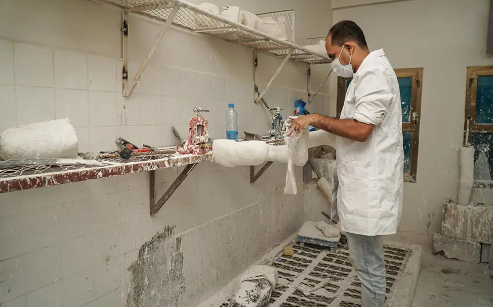 Jemen: Eine Prothese wird hergestellt | © UNICEF/Noman Jemen: Eine Prothese wird hergestellt