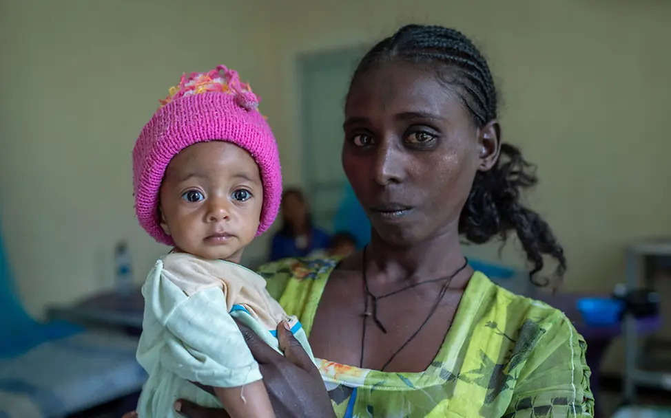 Eine Mutter hält ihr mangelernährtes Baby auf dem Arm. | © UNICEF/UN0475527/ Äthiopien Hungerkrise: Ein unterernährtes Baby bekommt Spezialnahrung gegen den Hunger.
