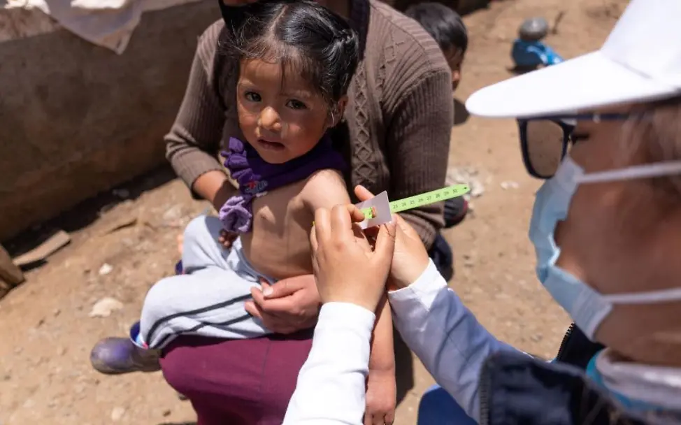 Dürre bedroht Kinder weltweit | ©UNICEF/Billy/AFP-Services Dürre: Der Oberarmumfang des Kindes verrät, ob es mangelernährt ist