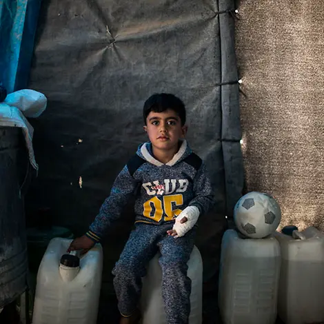 Minen und Blindgänger im Irak: Hussein wurde an der Hand verletzt | © UNICEF/Ibarra Sánchez Minen und Blindgänger im Irak: Hussein wurde an der Hand verletzt