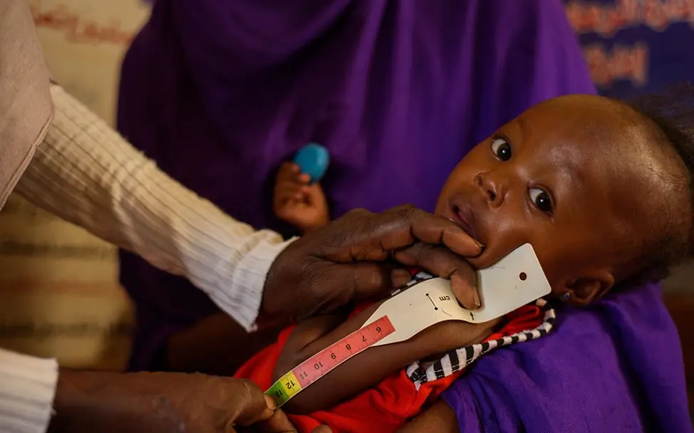 Mawada aus dem Sudan war schwer akut mangelernährt | UNICEF/Mohamdeen Drohende Hungersnot Sudan