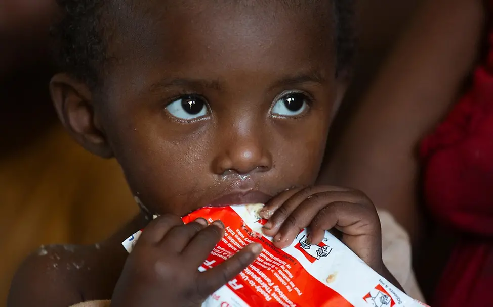 Erdnusspaste | UNICEF/Prinsloo RUFT_Madagaskar_UNI419092