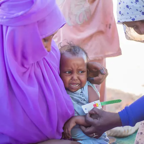 Malnutrition in Sudan | © UNICEF/UNI529918/Elfatih Mother with child in Sudan