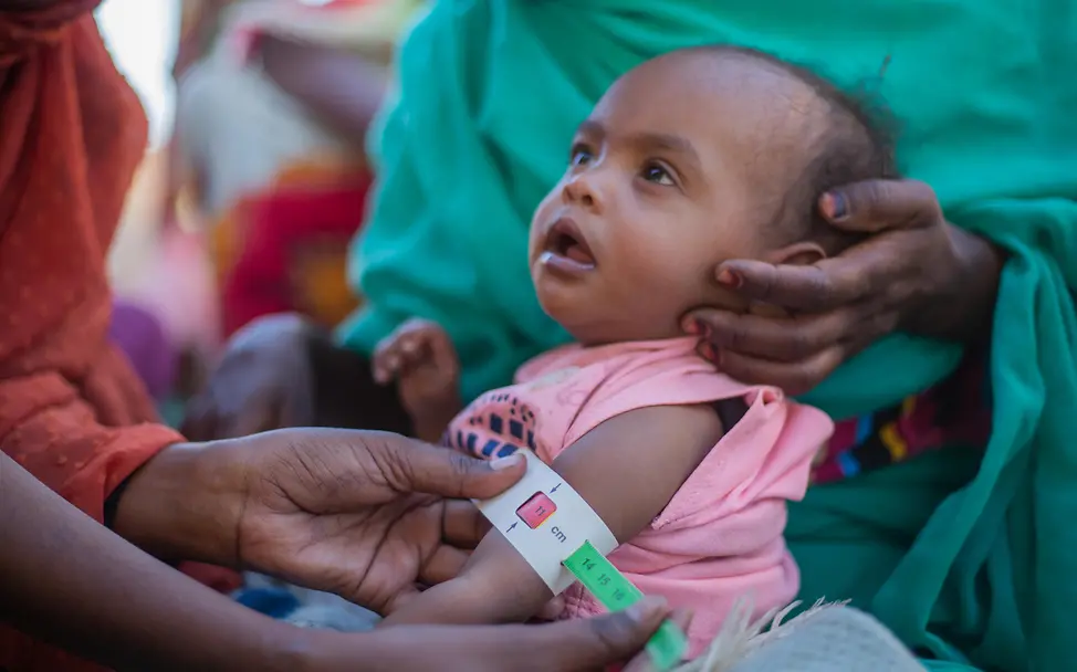 Malnutrition in Sudan |© UNICEF/UNI529849/Elfatih A child gets their arm circumference measured to check for malnutrition