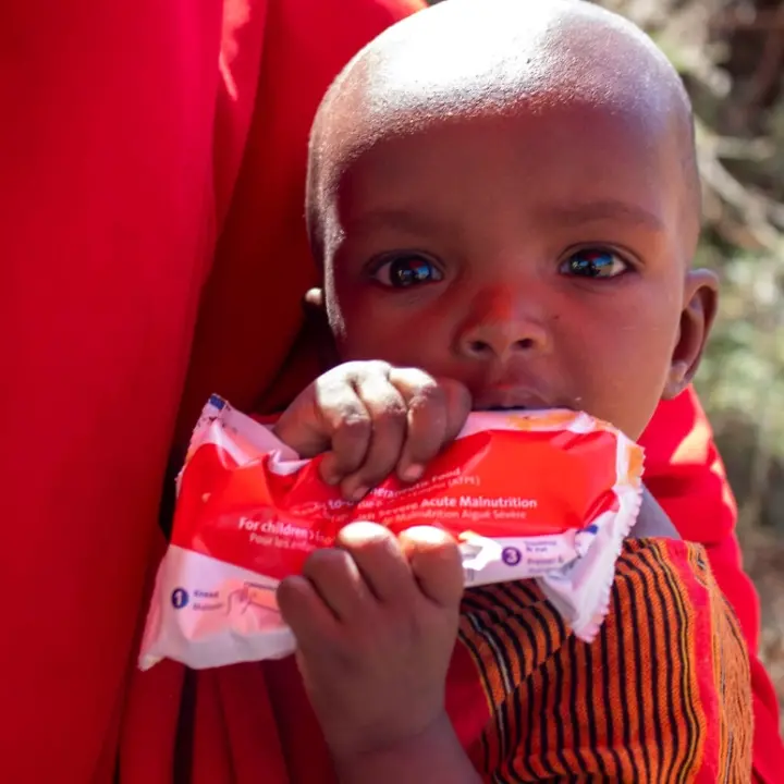 Hunger in Somalia: Die einjährige Mano kommt mit therapeutischer Spezialnahrung wieder zu Kräften. | © UNICEF/Hill Hunger in Somalia: Ein Kind bekommt Erdnusspaste zur Behandlung gegen Mangelernährung.
