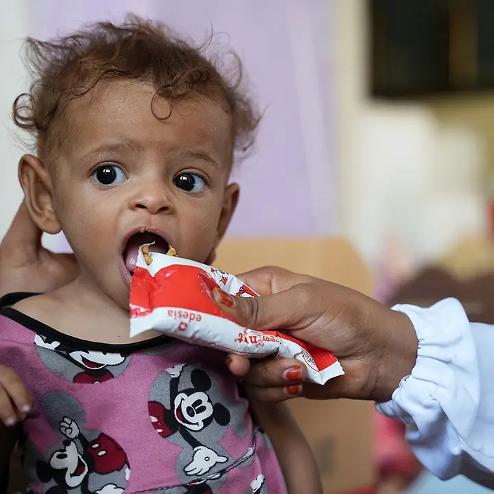 UNICEF hilft mangelernährten Kindern im Jemen mit therapeutischer Nahrung | © UNICEF/ALfilastini Jemen Hungersnot verhindern: Ein mangelernährtes Baby wird mit Spezialnahrung gegen den Hunger gefüttert.