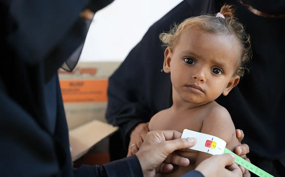 Ein mangelernährtes Kind im Jemen wird untersucht | © UNICEF/ALfilastini Hunger im Jemen: Tausende Kinder sind mangelernährt und brauchen Spezialnahrung