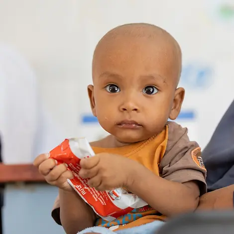 Omer aus dem Sudan leidet unter Mangelernährung | UNICEF/Elfatih Sudan Hungersnot: Omer wird mit Erdnusspaste gefüttert
