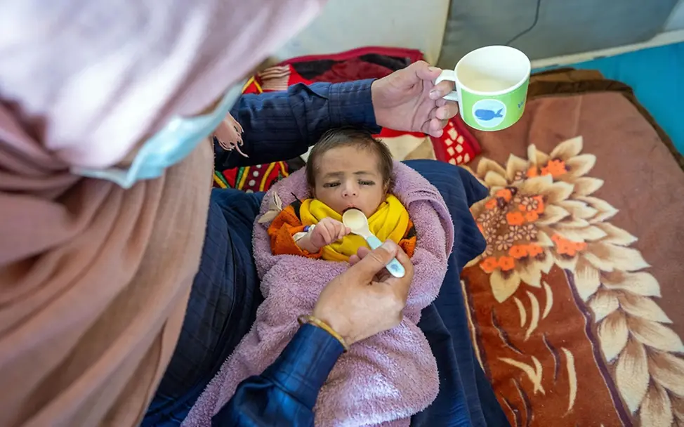 Afghanistan Kinder: Ein mangelernährtes Baby bekommt Spezialmilch | © UNICEF/Naftalin Afghanistan Kinder: Ein mangelernährtes Baby bekommt Spezialmilch