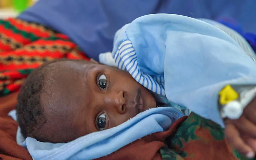 Hunger und Mangelernährung haben diesen Jungen stark ausgezehrt. | © UNICEF/Sewunet Hungersnot Afrika verhindern: Dieses Kleinkind in Somalia konnte mit Spezialnahrung gerettet werden.