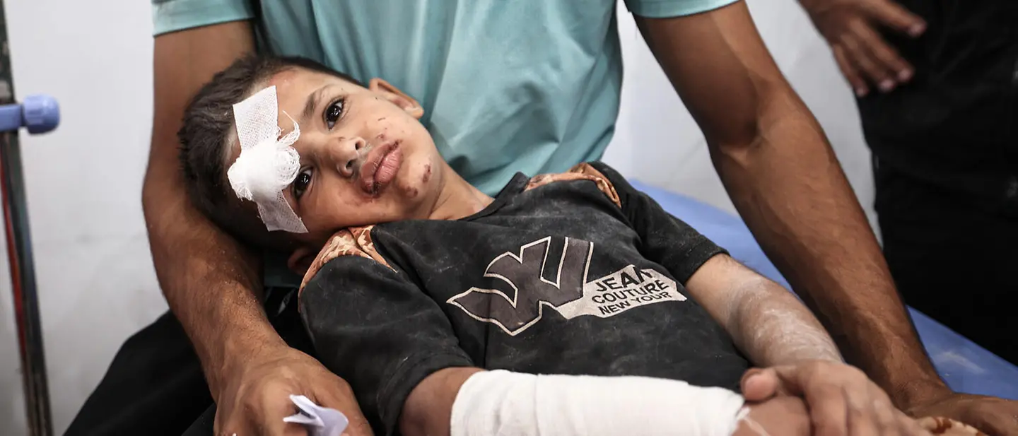 Children get severly injured during the war in Gaza | © UNICEF/UNI799060/El Baba A injured child in Gaza