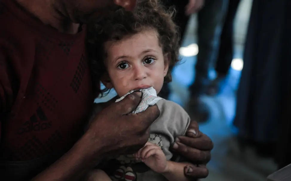 Rund 26.000 Kinder im Gazastreifen benötigen dringend eine Behandlung wegen Mangelernährung | © UNICEF/Nateel News Gaza: Rund 26.000 Kinder im Gazastreifen benötigen dringend eine Behandlung wegen Mangelernährung