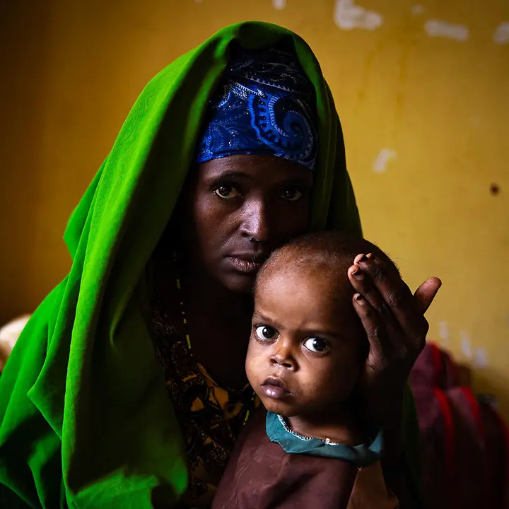 Äthiopien Hunger: UNICEF hilft mangelernährten Kindern und leistet Nothilfe