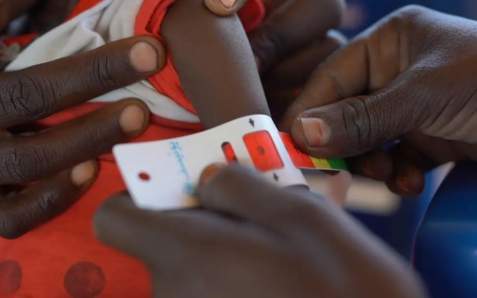 Ein Kind wird auf Mangelernährung untersucht.