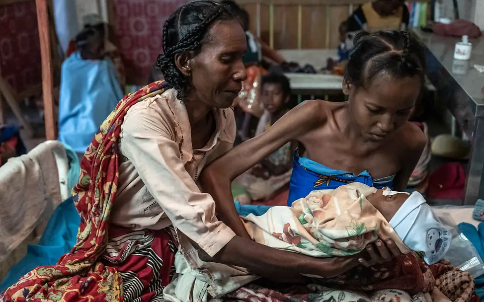 Madagaskar Hungerkrise: Eine stark mangelernährte Mutter hält ihr mangelernährtes Baby auf dem Arm.