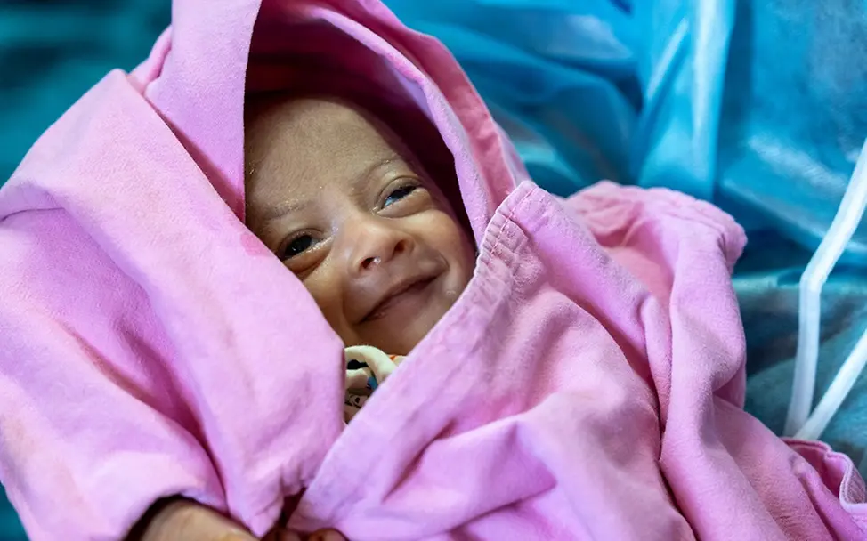 Sarid wurde zu früh geboren,  dank Neugeborenenversorgung überlebte er.