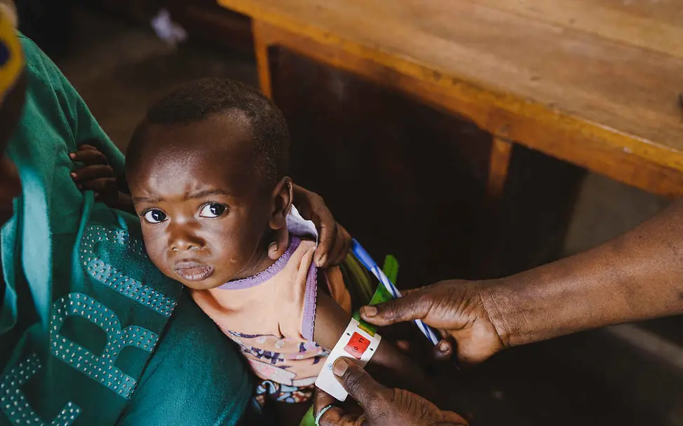 Kriegskinder im Kongo: Ein Kleinkind wird auf dem Arm seiner Mutter auf Mangelernährung untersucht.